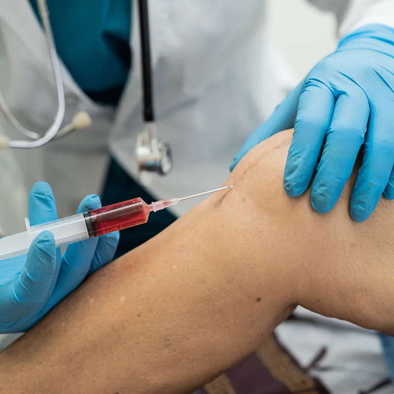 Cómo funciona la extracción de células madre: métodos autólogos vs. alogénicos explicados